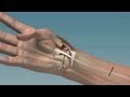 A Pain-Free Thumbs Up - Mayo Clinic