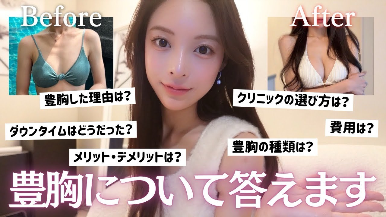 【Before→After公開】豊胸のリアル全部答えます（痛み・費用・後悔）✨