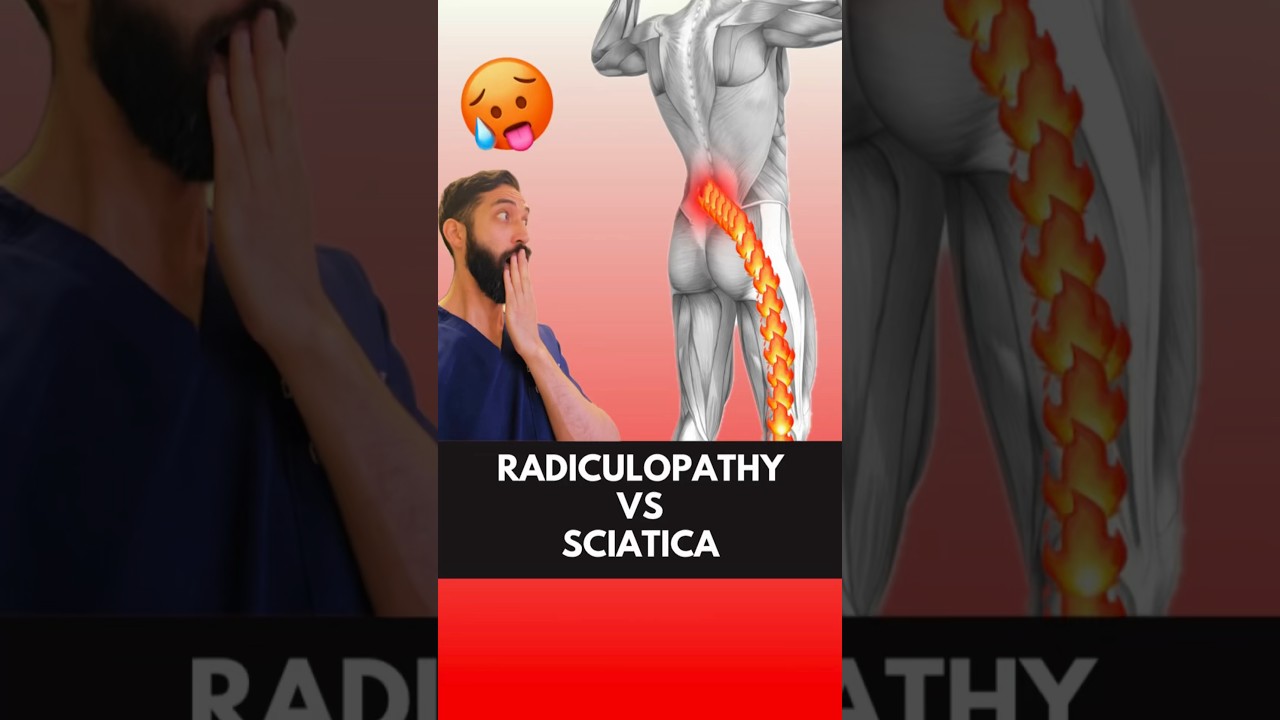 The Truth About Radiculopathy VS Sciatica: Revealed