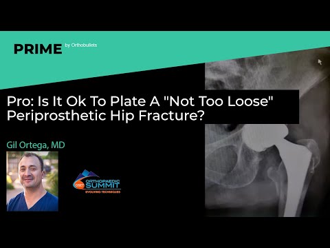 Pro: Is It Ok To Plate A "Not Too Loose" Periprosthetic Hip Fracture? - Gil Ortega, MD