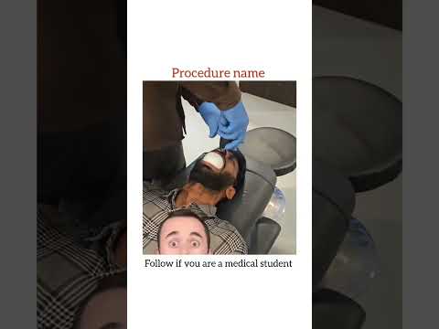 Baloon Sinuplasty Surgical Procedure || Sinusitis Treatment |  #views #entdoctor #procedure #medical