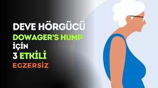 Deve Hörgücü (Dowager’s Hump) 3 Etkili Egzersiz | Fizyoterapist Fatma Aman