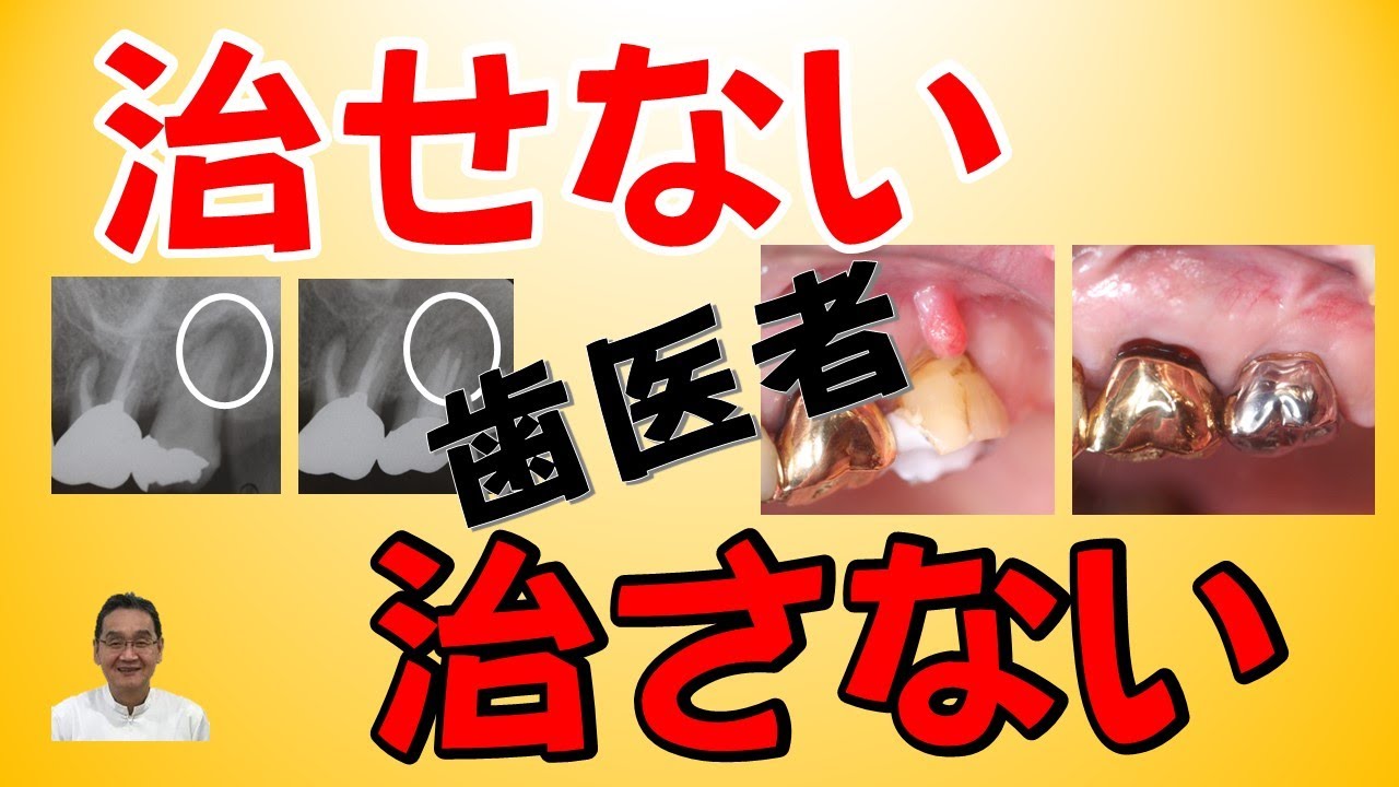 治さない・治せない歯医者