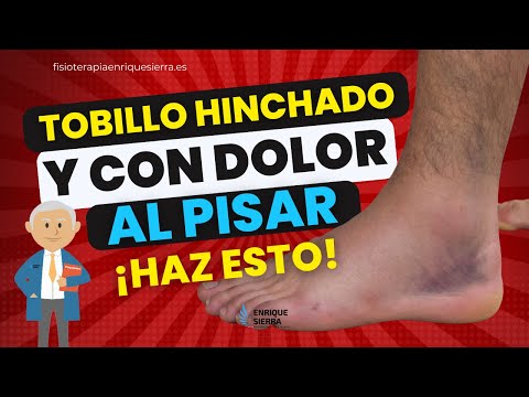TOBILLO HINCHADO Y DOLOR AL PISAR: ¡HAZ ESTO! ✅