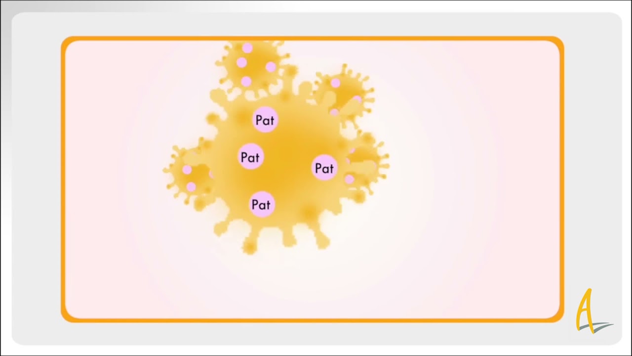 What is ankylosing spondylitis?