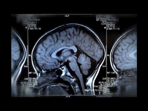 NSi Inventor of the Year finalist: Philip Hogg