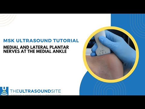 MSK ultrasound evaluation of the medial and lateral plantar nerves