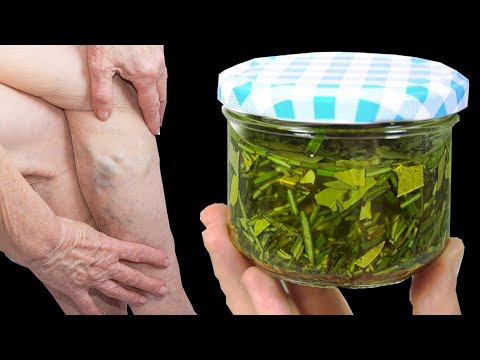 Incredible! Varicose veins disappear with the help of rosemary! A treasure that everyone should have