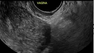 Download lagu Video 5: Normal vagina mp3 Download lagu Video 5: Normal vagina mp3