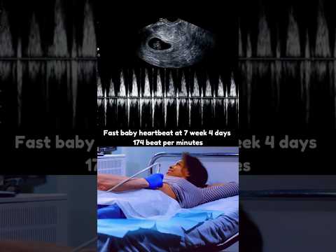 7 Weeks 4 Days Fast Baby Heartbeat 💓 Early pregnancy heartbeat, boy or girl?
