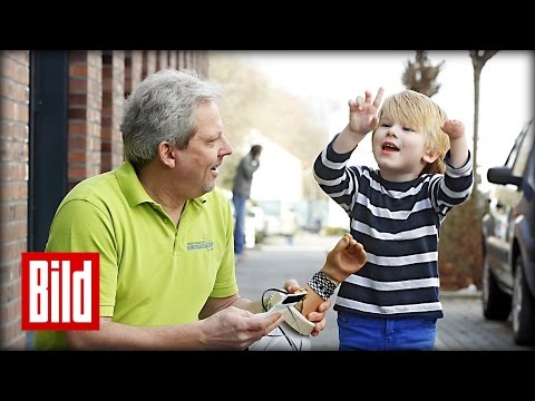 Junge (4) übt mit neuer Hand-Prothese -  Orthopädie-Handwerk / Amputation