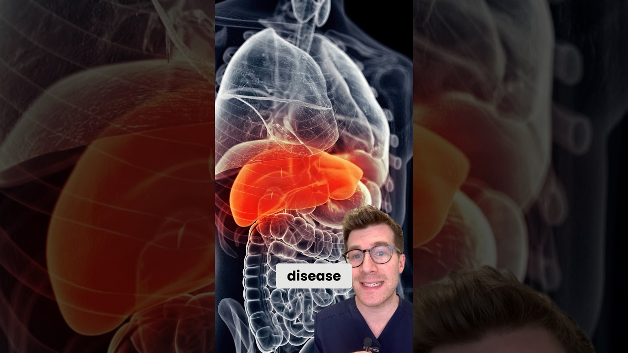 9 simptoma masne jetre: znakovi upozorenja koje ne možete ignorirati #kratke hlače