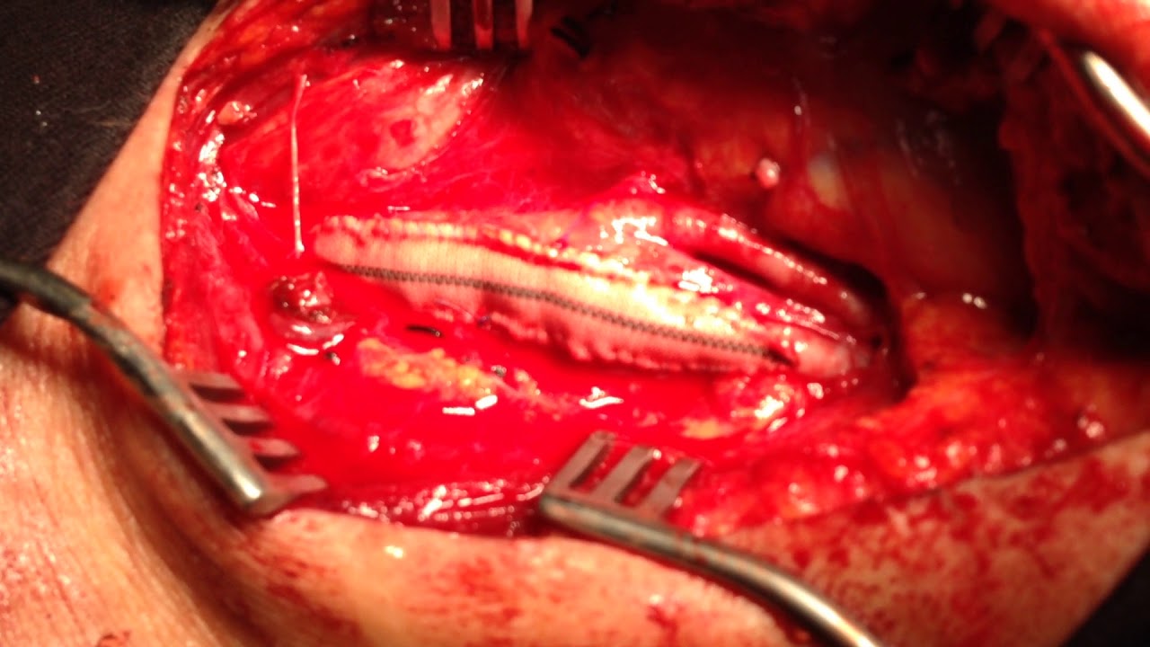 Ricardo Wagner Vasquez-33