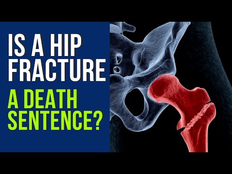 Is a Hip Fracture a Death Sentence?