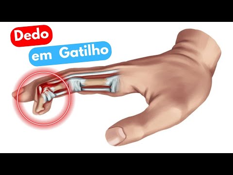 download lagu mp3 mp4 Dedo De Gatilho, download lagu Dedo De Gatilho gratis, unduh video klip Dedo De Gatilho