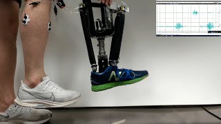 Newswise:Video Embedded neurally-controlled-prosthetic-ankle-allows-for-intuitive-balance-correction