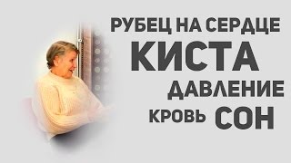 Как от такого можно выздороветь? Рубец на сердце, киста, давление, сон, кровь.