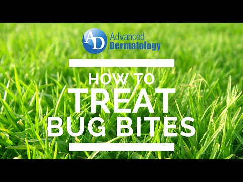 How to Treat Gnat Bites
