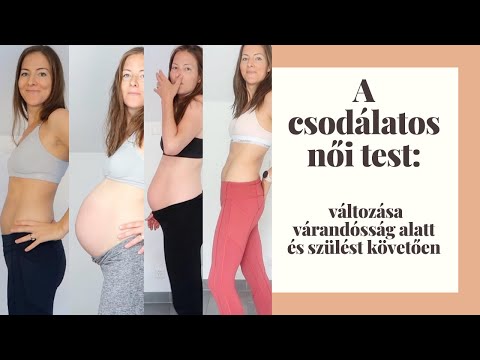 Ha visszérrel húzza a lábát - A visszér Syzran kezelése