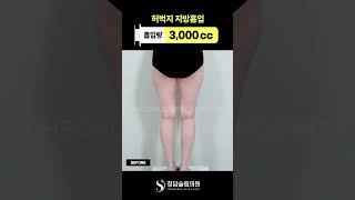 허벅지 하나 달라졌는데 비율이 달라보임;;😮