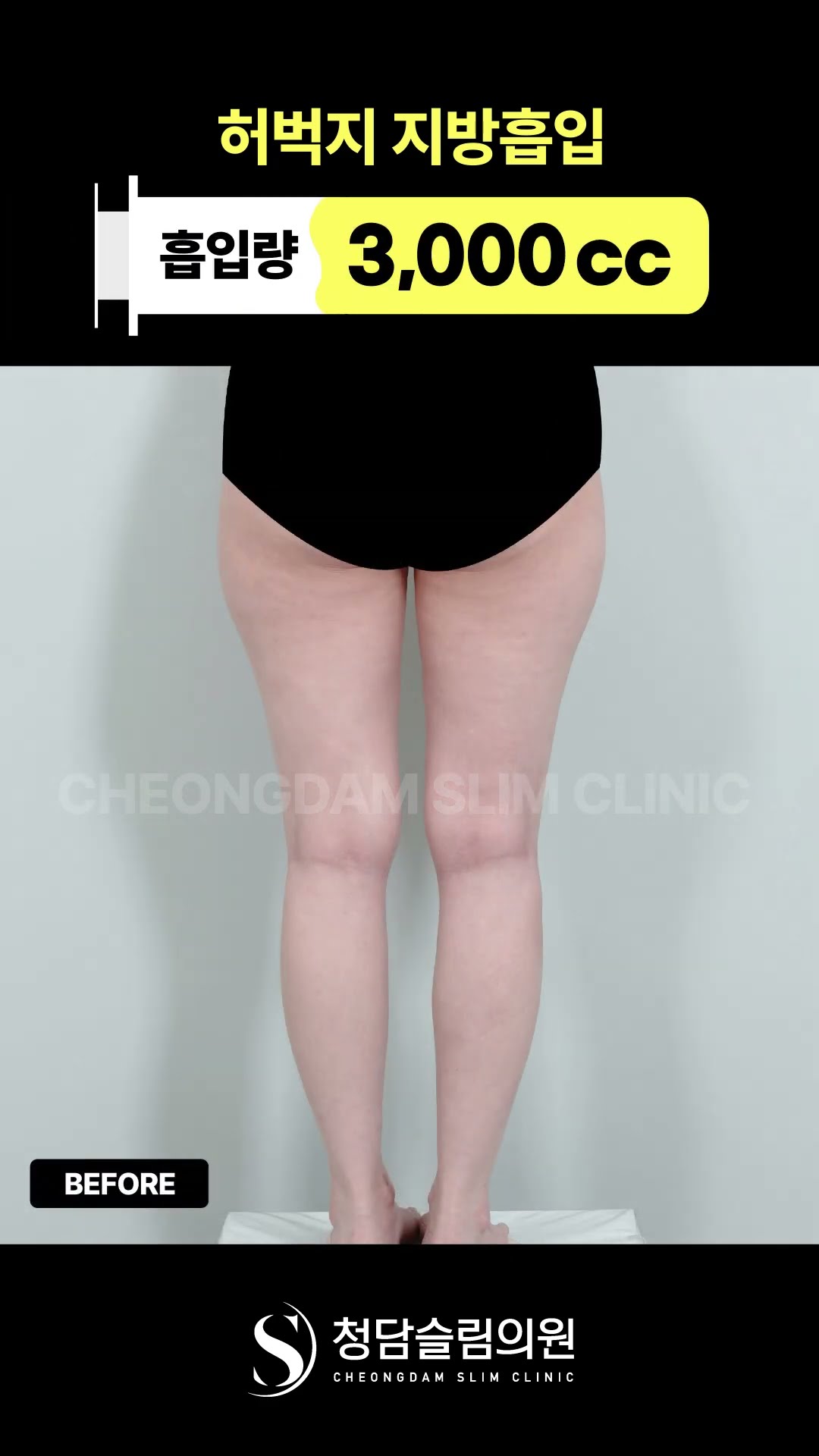 허벅지 하나 달라졌는데 비율이 달라보임;;😮