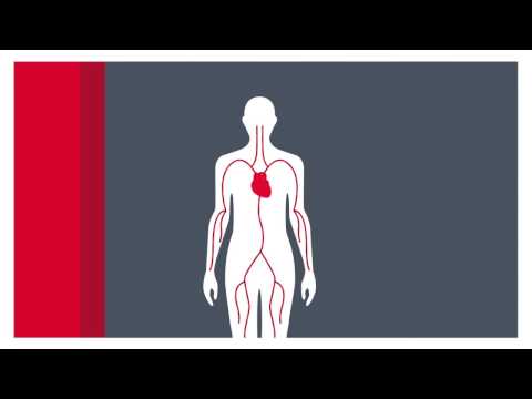 What is atrial fibrillation?