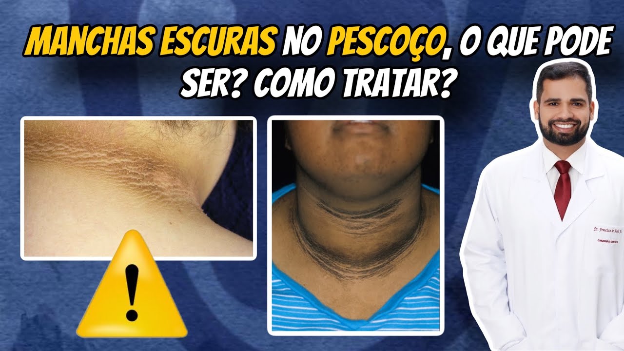 Francisco De Assis Almeida Lima Júnior-40