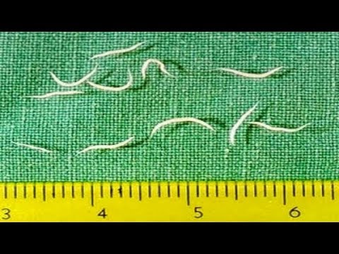 Pinworms egy nő tünetei Helminták a hüvelyben