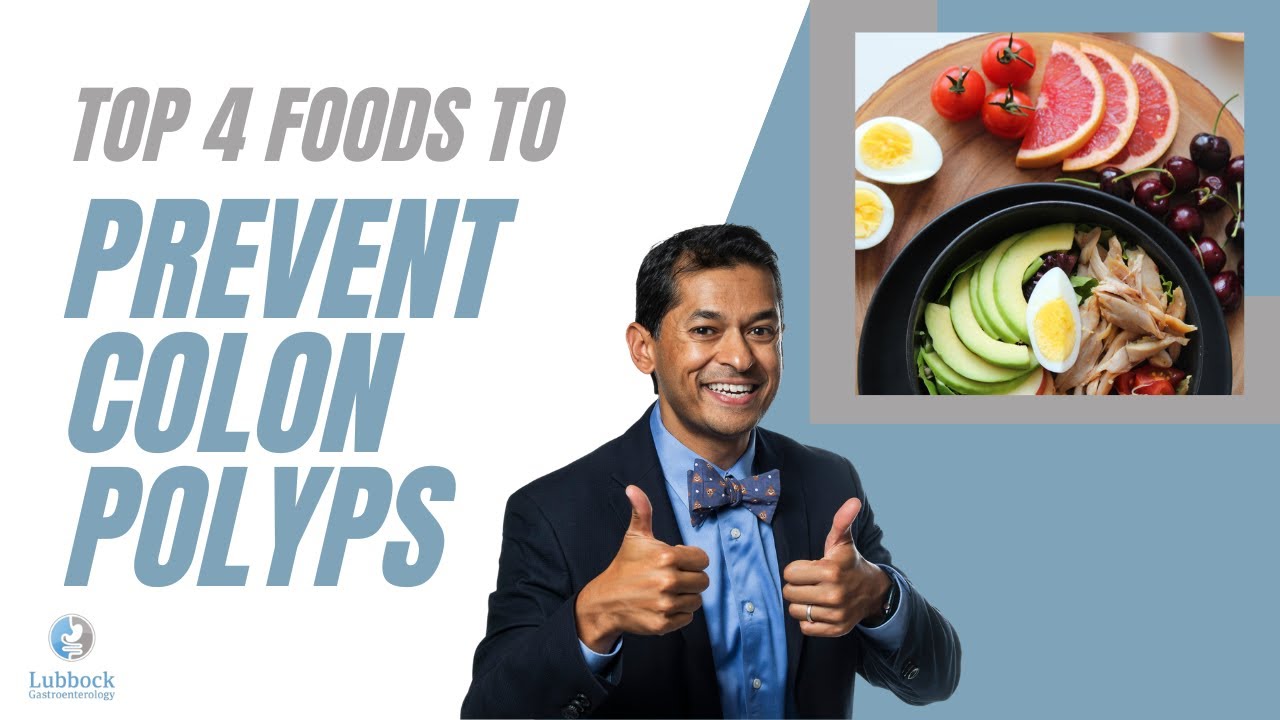 Foods that prevent polyps: colon edition