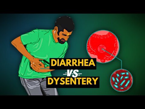 Differences between Diarrhea and Dysentery...