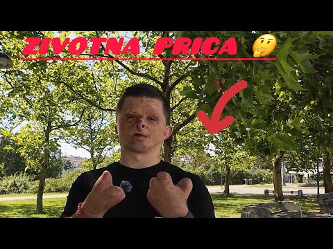 Zivotna prica kako sm izgoreo sa 2 godine u vatri kada sam bio mali