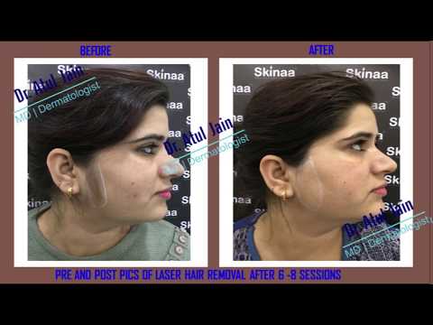 download lagu mp3 mp4 Dr Atul Jain Md Jaipur Rajasthan, download lagu Dr Atul Jain Md Jaipur Rajasthan gratis, unduh video klip Dr Atul Jain Md Jaipur Rajasthan