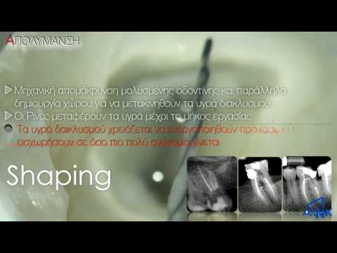 Οι Διακλυσμοί στην Ενδοδοντία. (Dental TTT - Webinar No 39).