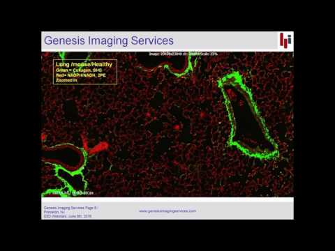 SHG Imaging in Pulmonary Fibrosis Lung
