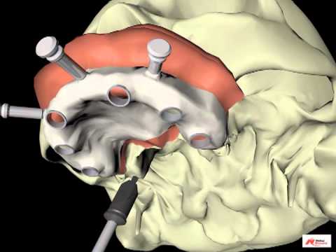 Procera3DSoftware