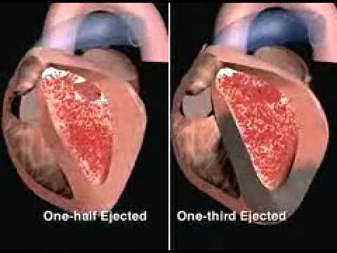 The Ejection Fraction Animation