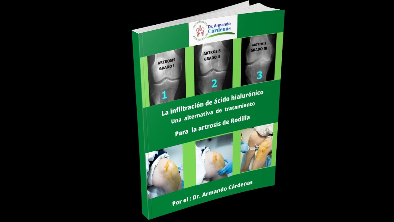 Rey Armando Cárdenas Acuña-13