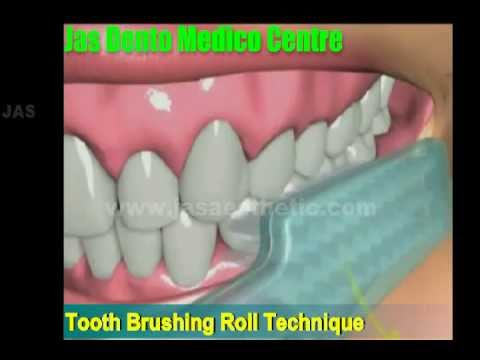 Dental Patient Educatio Part 1 (2).flv