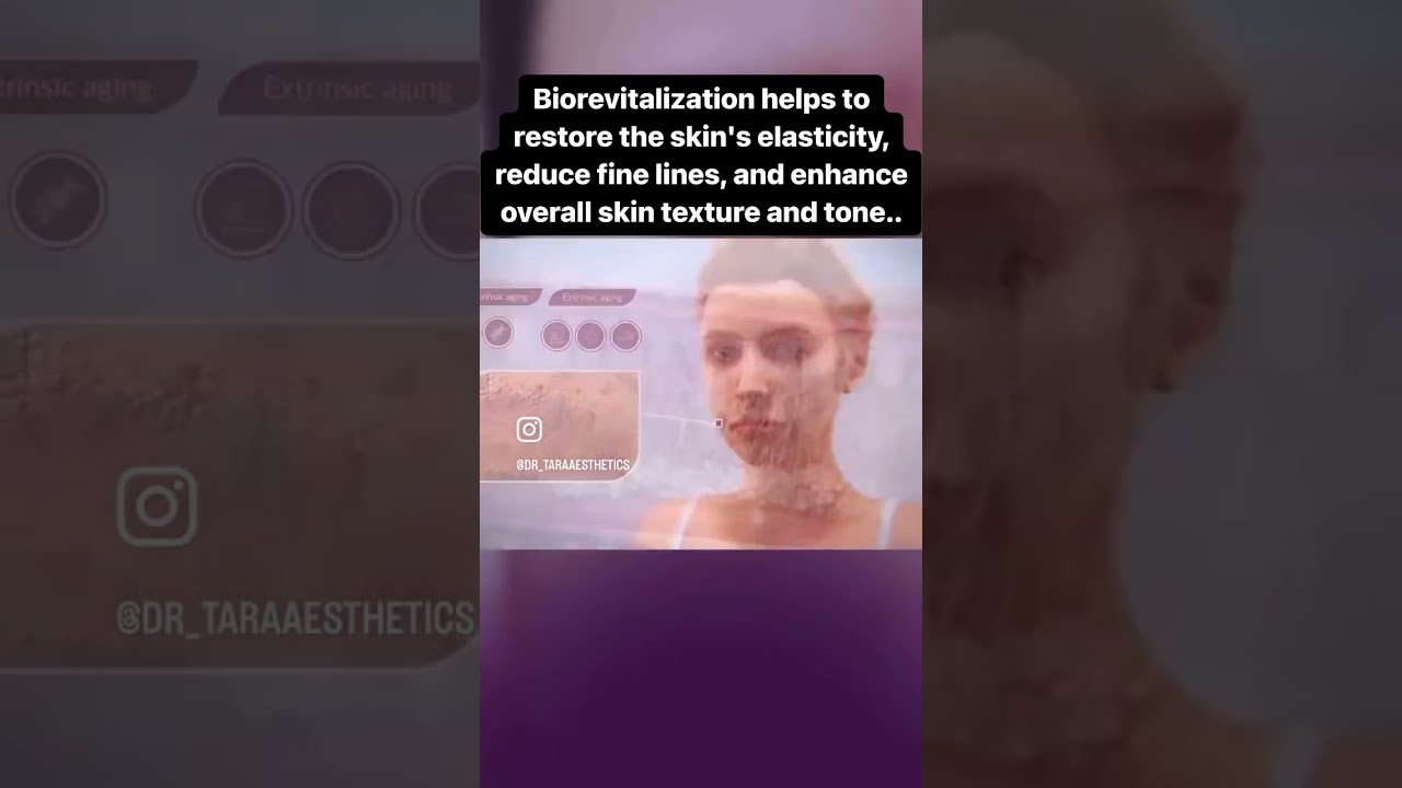 Skin rejuvenation with biorevitalization