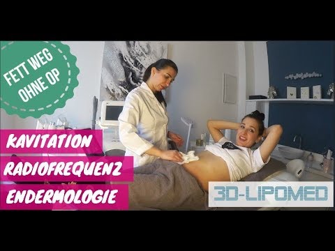 download lagu mp3 mp4 Kavitation Fettabbau, download lagu Kavitation Fettabbau gratis, unduh video klip Kavitation Fettabbau