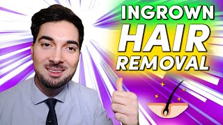 How To Get Rid Of Ingrown Hair Removal and Treatment