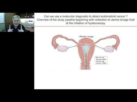 John Martignett -The Pandora's box of molecular diagnostics: Genomic analysis of uterine lavage....