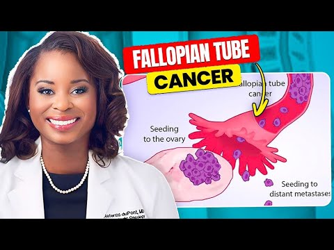What You Need to Know About Fallopian Tube Cancer