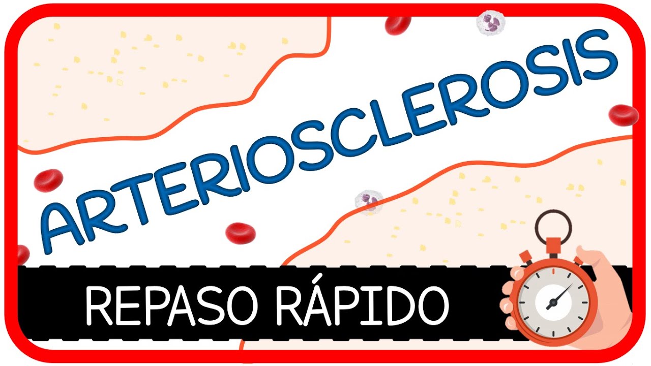 ARTERIOSCLEROSIS [REPASO RÁPIDO] 🏃🕙- Arteriolosclerosis, Esclerosis de Mönckeberg y Aterosclerosis