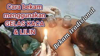 Download lagu Cara bekam menggunakan gelas kaca & lilin mp3