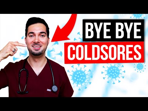 How to get rid of a cold sore fast and treatment remedies