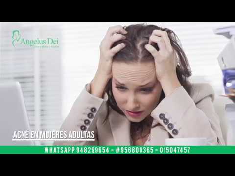 Acné en Mujeres Adultas