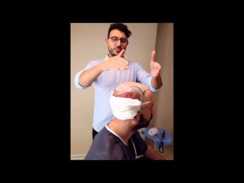 Il calendario lunare di maschere per rafforzarsi di capelli Polvere di zenzero di capelli in maschere