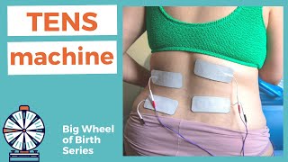 TENS UNIT: using a tens machine in labor