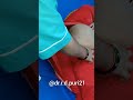 Im Injection Vlog Video Female Buttock Injection Vlog New Intramuscular Injection Video